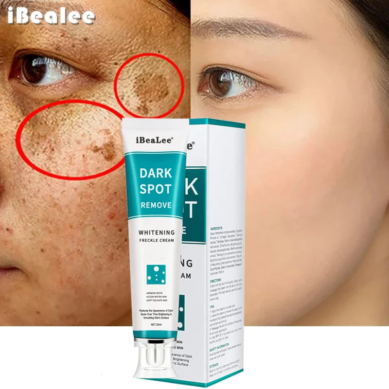 Licorice Root Sticks - Effective Whitening Freckles Cream Remove Melasma