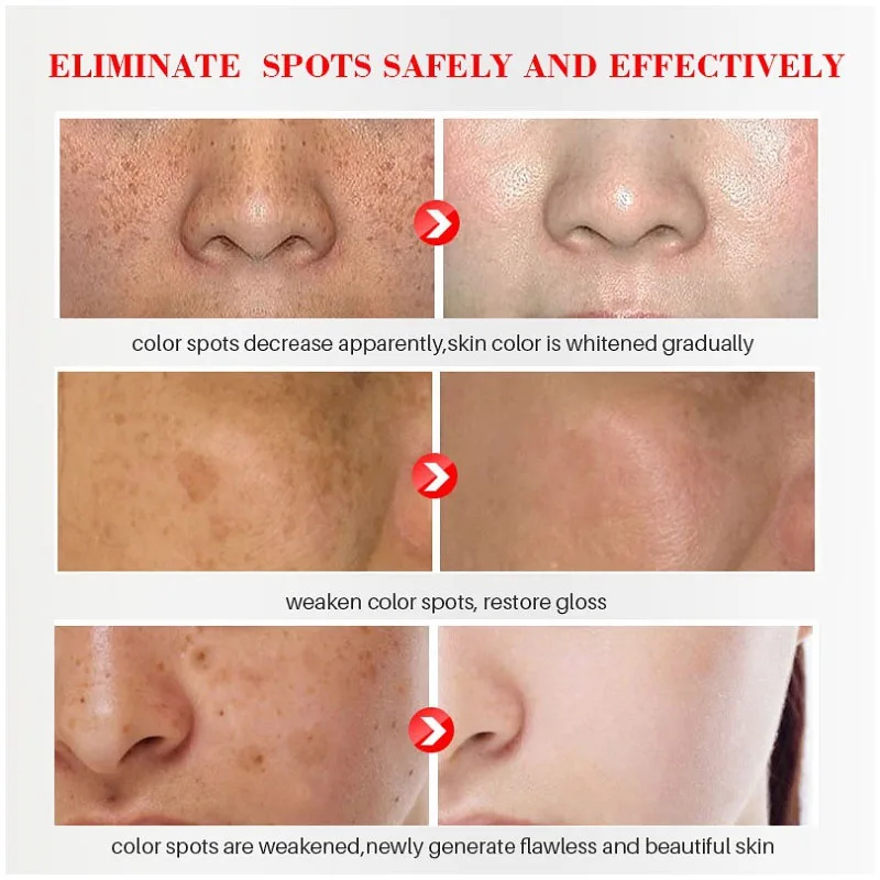 Effective Whitening Freckles C - огляд і ціна Licorice Root Sticks