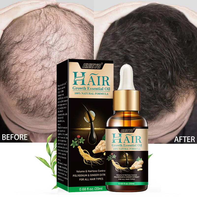 2023 Biotin Fast Hair Growth O - огляд і ціна Licorice Root Sticks