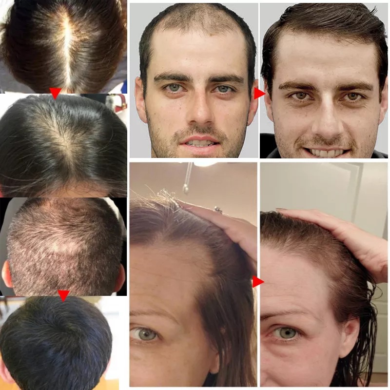 2023 Biotin Fast Hair Growth O - огляд і ціна Licorice Root Sticks