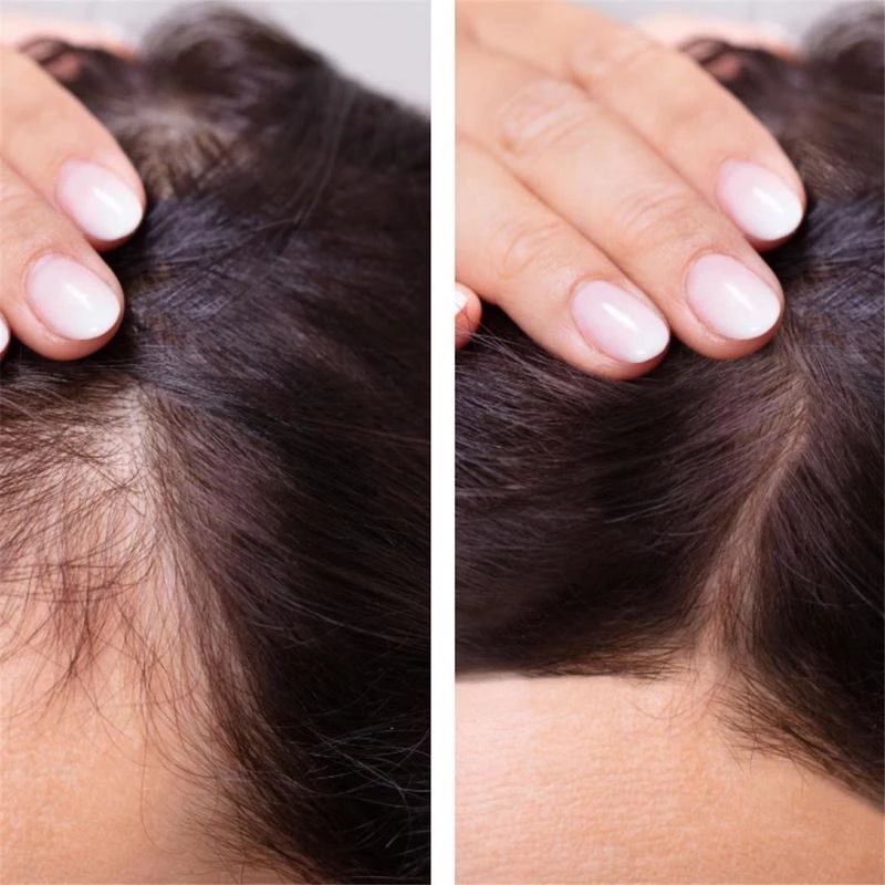 2023 Biotin Fast Hair Growth O - огляд і ціна Licorice Root Sticks