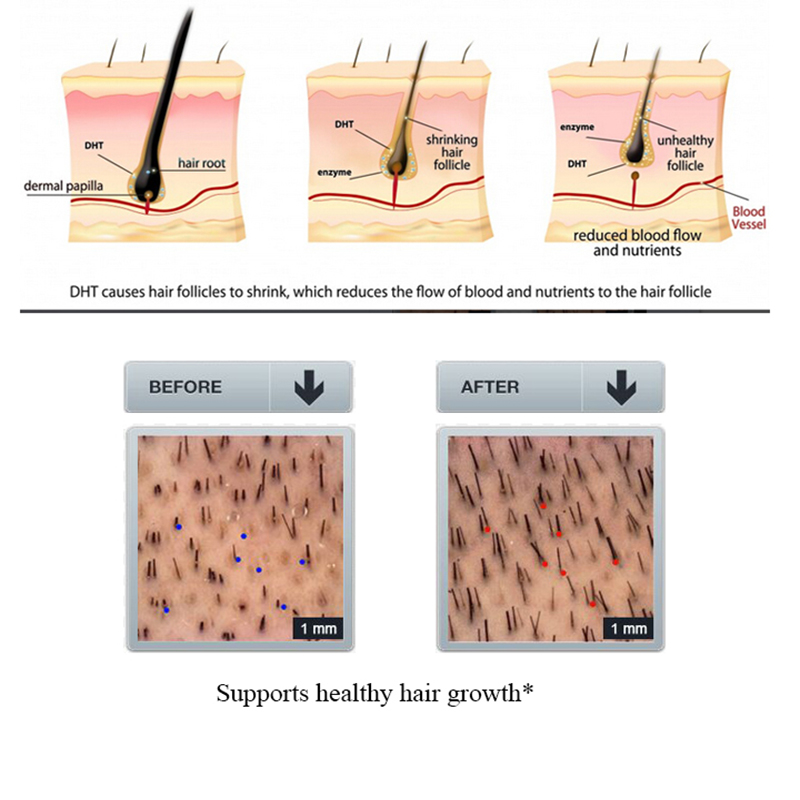 PURC 100ml Ginger Hair Loss Sh - огляд і ціна Licorice Root Sticks